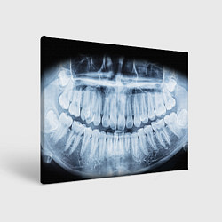 Холст прямоугольный Зубной Рентген, цвет: 3D-принт