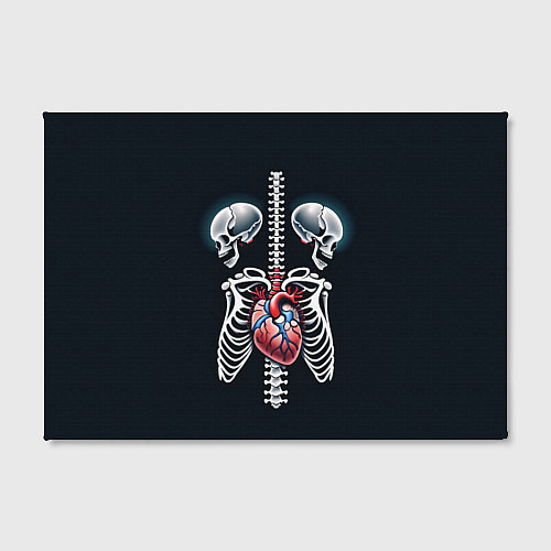 Картина прямоугольная Два сросшихся скелета и сердце / 3D-принт – фото 2