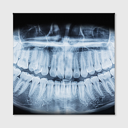 Картина квадратная Зубной Рентген / 3D-принт – фото 2