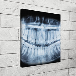 Холст квадратный Зубной Рентген, цвет: 3D-принт — фото 2
