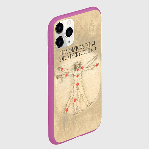 Чехол iPhone 11 Pro матовый Травматология как искусство / 3D-Фиолетовый – фото 2