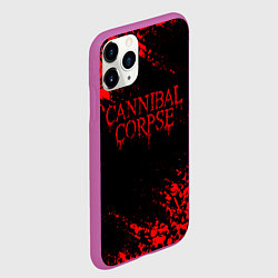 Чехол iPhone 11 Pro матовый CANNIBAL CORPSE КРАСНЫЕ ЧЕРЕПА, цвет: 3D-фиолетовый — фото 2