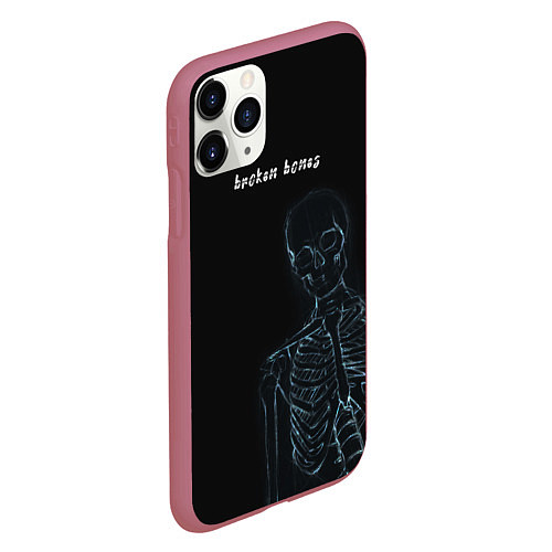 Чехол iPhone 11 Pro матовый Broken bones / 3D-Малиновый – фото 2