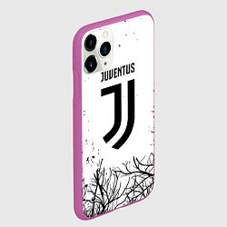 Чехол iPhone 11 Pro матовый Ювентус черные деревья, цвет: 3D-фиолетовый — фото 2