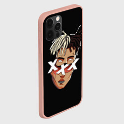 Чехол для iPhone 12 Pro Max XXXTentacion Head, цвет: 3D-светло-розовый — фото 2