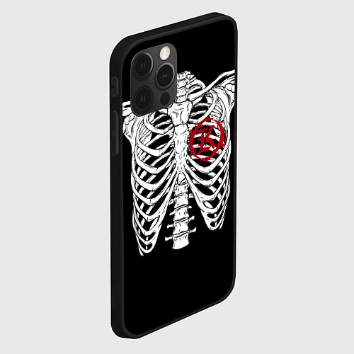 Чехол iPhone 12 Pro Кукрыниксы: Скелет / 3D-Черный – фото 2