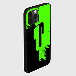 Чехол для iPhone 12 Pro BILLIE EILISH БИЛЛИ АЙЛИШ, цвет: 3D-черный — фото 2