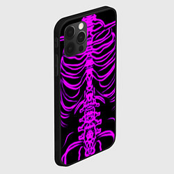 Чехол для iPhone 12 Pro Розовые кости, цвет: 3D-черный — фото 2