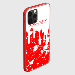 Чехол для iPhone 12 Pro BLOODBORNE брызги, цвет: 3D-красный — фото 2