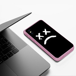 Чехол iPhone XS Max матовый Lil Peep: RIP Smile, цвет: 3D-розовый — фото 2
