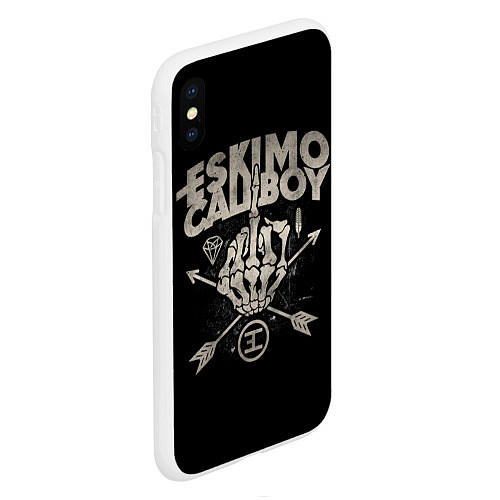 Чехол iPhone XS Max матовый Eskimo Callboy: Bones / 3D-Белый – фото 2