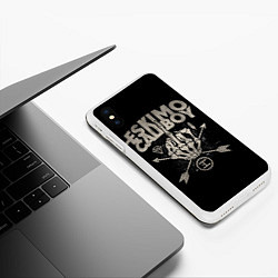Чехол iPhone XS Max матовый Eskimo Callboy: Bones, цвет: 3D-белый — фото 2