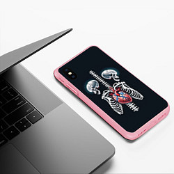 Чехол iPhone XS Max матовый Два сросшихся скелета и сердце, цвет: 3D-баблгам — фото 2
