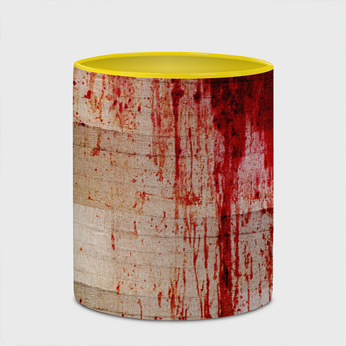 Кружка цветная Бинты 1 / 3D-Белый + желтый – фото 2